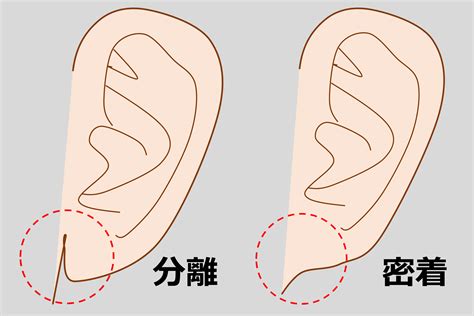 耳形|あなたの耳はどんな形？ 縁起の良い耳の形をした遺伝子タイプ。